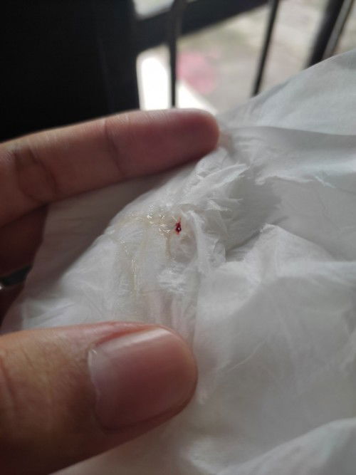 Keluar lendir UK 40week2day