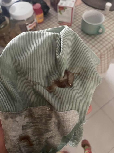 Keluar air dan lendir warna coklat 39 minggu