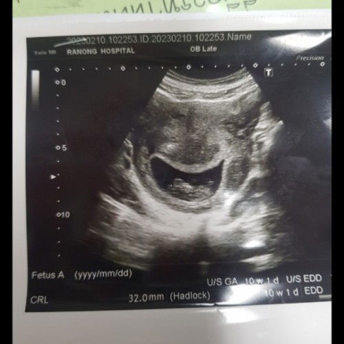 ภาพซาวด์10w1d