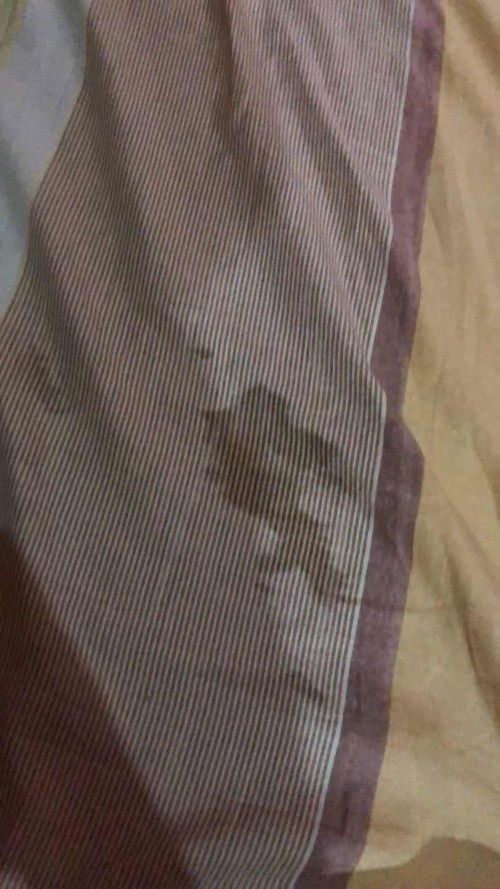 Ini air ketuban atau keputihan ya bunda?