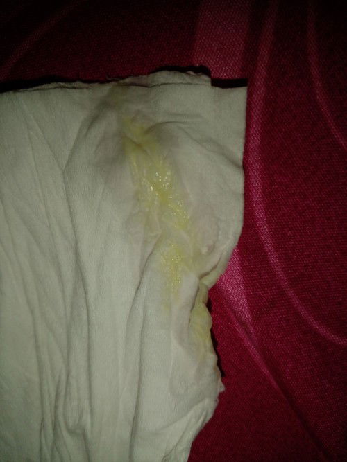 37w1d udh 2hri keputihan gini bun ada yg sama gak ya?