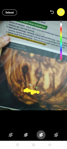 USG Minggu ke 20. Ada yg bisa nebak jenis kelamin bunda