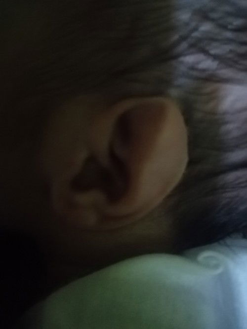 Ears ni baby