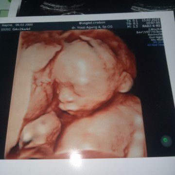 Assalamualaikum hpl 22 juni bbj janinku 470gram