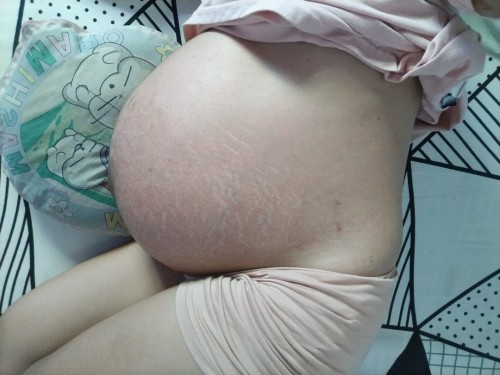 TWIN PREGNANCY