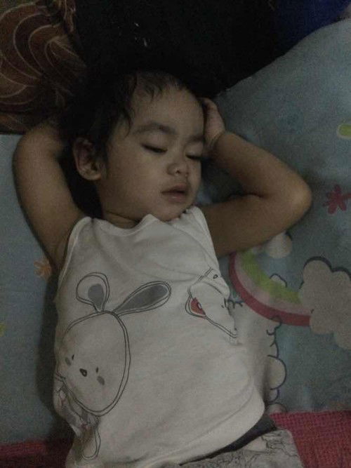 pamamaga dahil sa sakit ng ipin