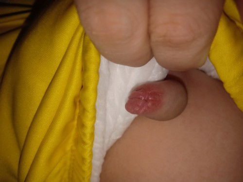 Bé e trên 2 tuổi bị như thế này ngày hôm nay ,
Như này là bị hâm tả hay s vậy ạ 
E lo quá