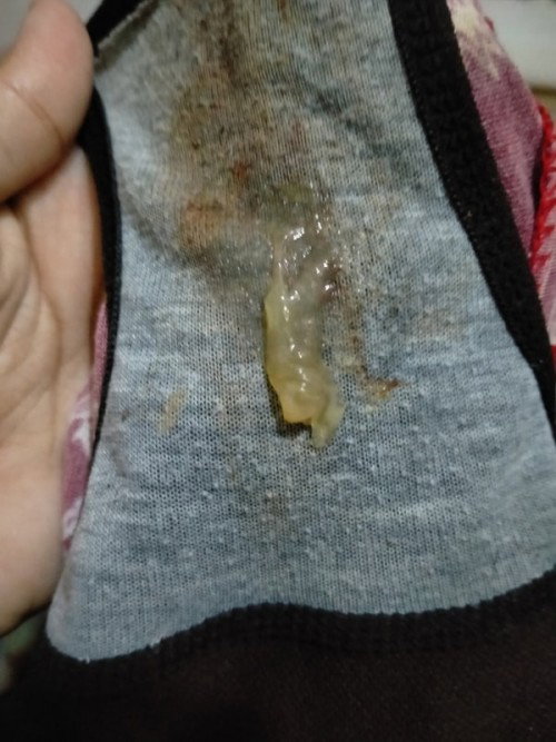 MUCUS PLUG NABA TOH ?