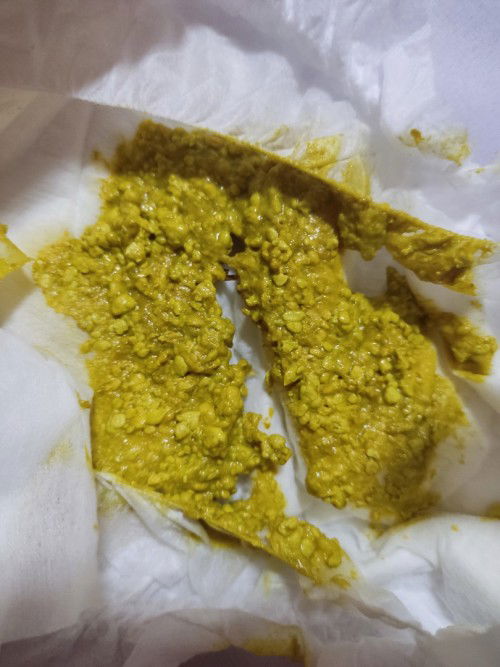 อึน้องเป็นเม็ด