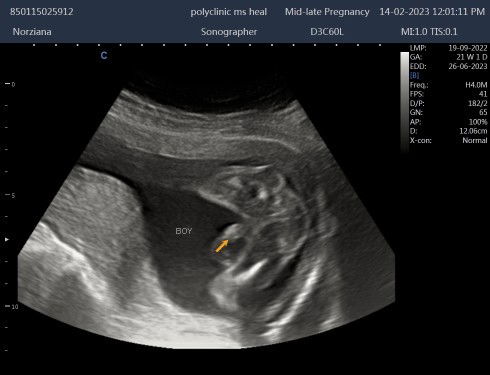 Scan ni comfirm boy?