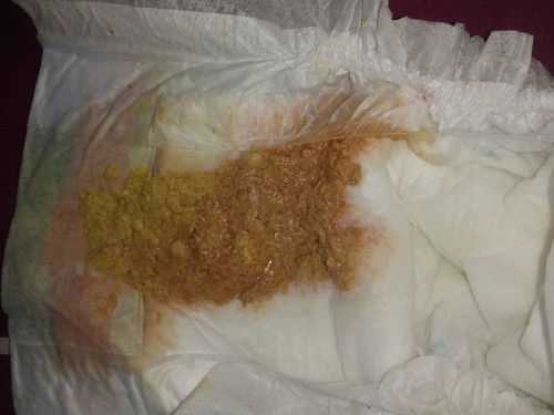 Apa normal bab bayi kayak gini?