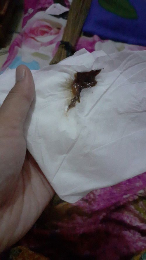 Hamil 39week keluar flek coklat