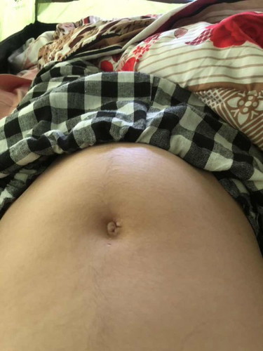 ท้องนุนๆข้างขวา จะเป็นไรไหมค่ะ?