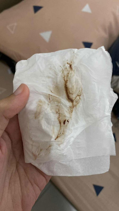 Flek cokelat di usia 23 week