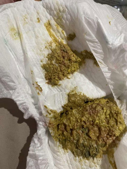 Blood in poop and some poop like blackish in color