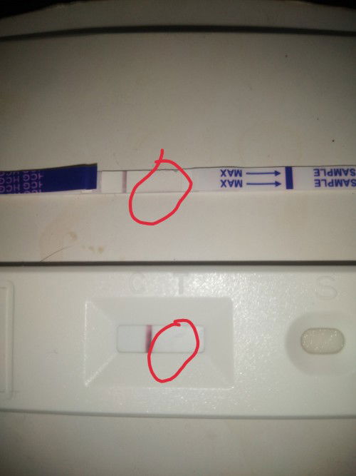 มีอาการแพ้ท้องตั้งครรภ์1เดือนตรวจกับหมอบอกท้องแต่ซื้อที่ตรวจมาตรวจเองขึ้นขีดเดียว