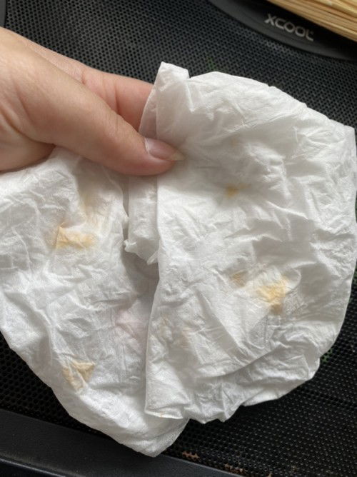 Bercak Pink dari miss v