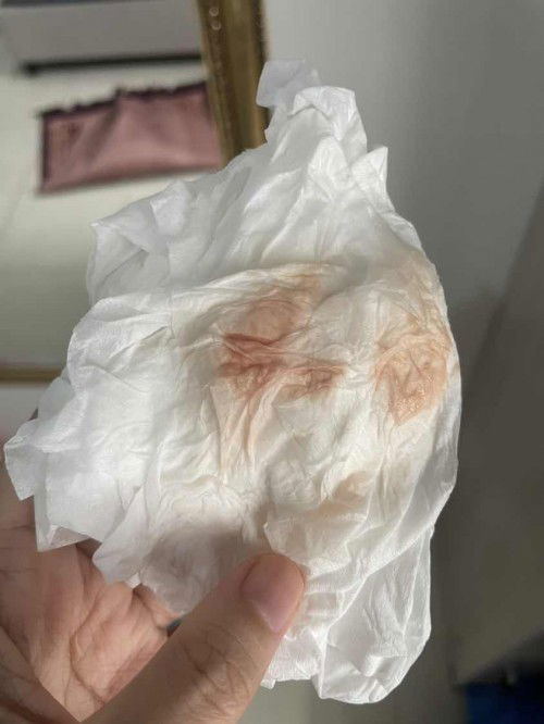 Usia kandungan 8 week