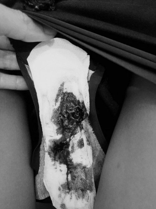 ตั้งครรภ์