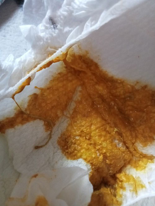 Normal ba na parang may maliit na bituka sa dumi ni baby 1month plng Po sya