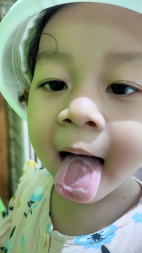 Lidah anak