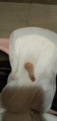 Mucus plug