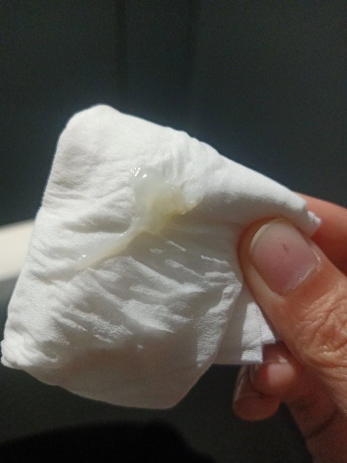 เป็นตกขาวแบบนี้ผิดปกติไหมค่ะ