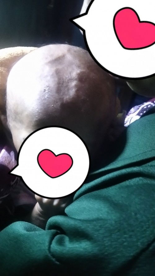 kenapa ubun ubun bayi cekung