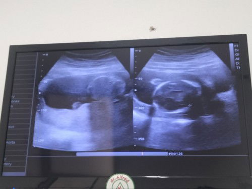 Masya Allah tabarakallah bund. 20w3d tendangan cinta sudah mulai kuat🤭🤭