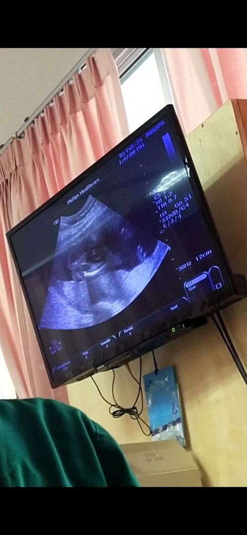 เรื่องเพศลูก