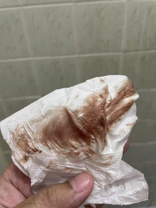 แม่ ๆ คนไหนตรวจมะเร็งปากมดลูก แล้วเลือดออกบ้างคะ