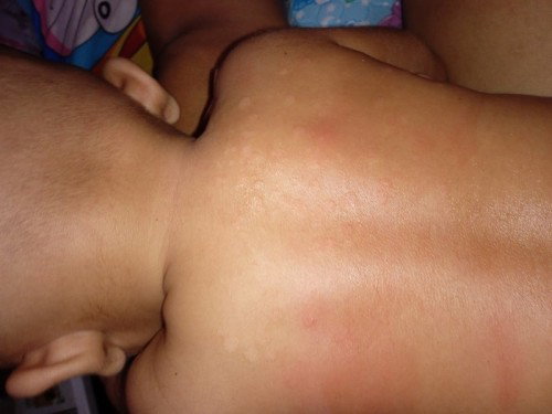 Bayi usia 4 bulan bagian belakang putih putih