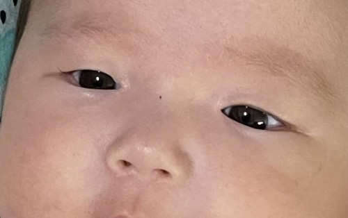 Baby eye seem a bit slanted