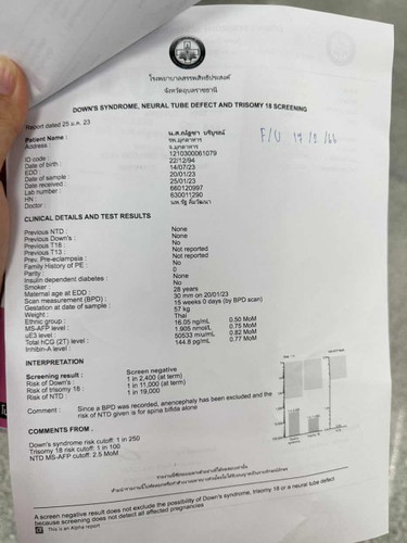 ผลตรวจดาวน์ซินโดม