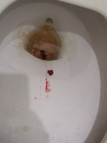 Due date ko ngayon