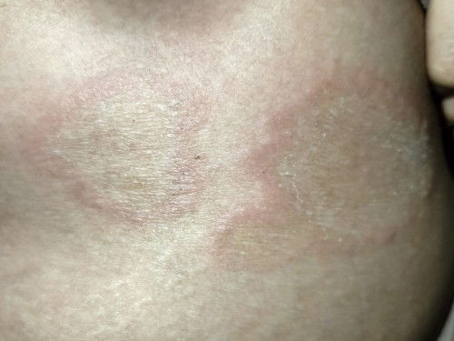 Dokter bilang janin cacat karena salep