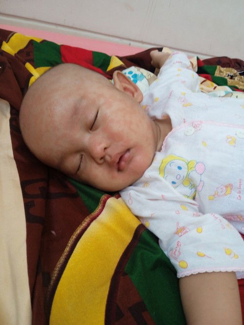 Muka dan badan merah