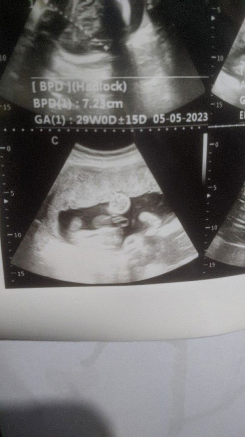 Hasilusg#jeniskelamin#