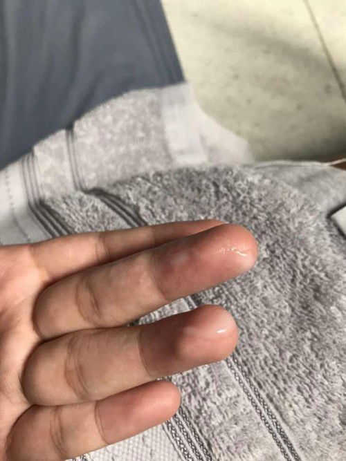 รบกวนสอบถามแม่ๆนะคะ (หากรูปไม่เหมาะสมขออภัยด้วยนะคะ)