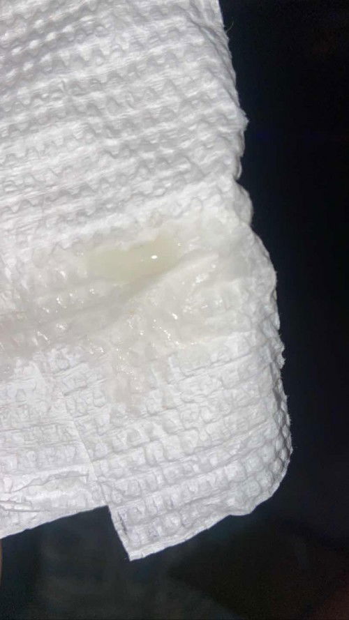 KETUBAN ATAU KRPUTIHAN ?