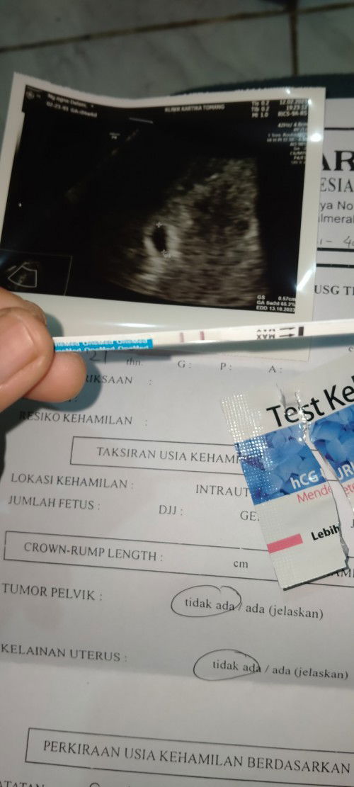 Kehamilan usia 5week+2hari