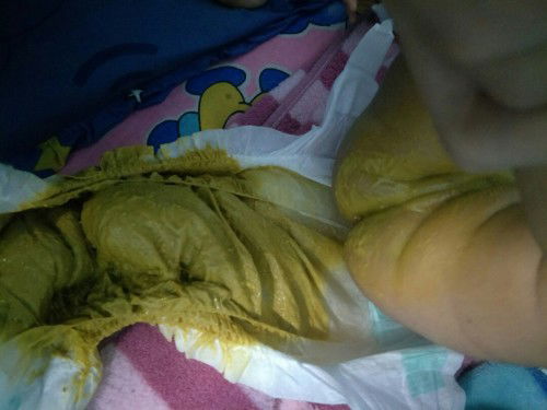 น้องทานนมผงได้2วันสีอึแบบนี้ผิดปกติไหมคะแม่ๆ