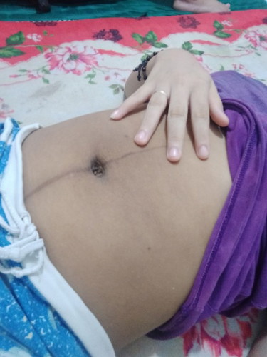 perut hitam paska melahirkan.