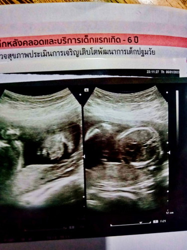 อันนี้หน้าเค้าใช่ไหมคะ