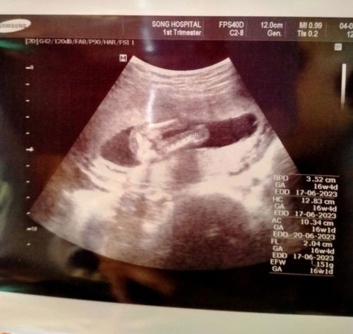 ช่วยเดาเพศลูกหน่อยค่ะแม่ๆ