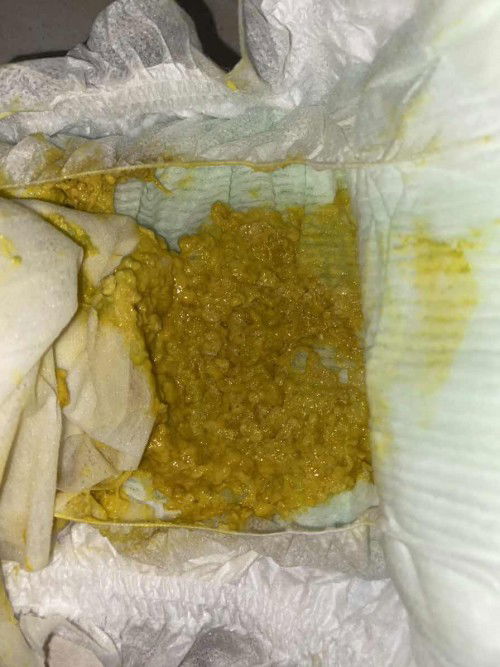 Bantu jawab soalnya aku newmom