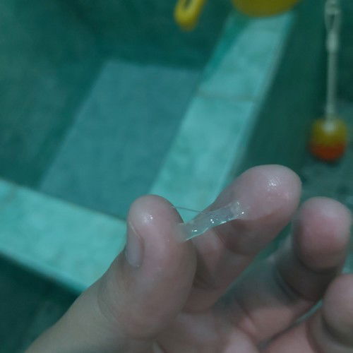 Keluar lendir bening kental