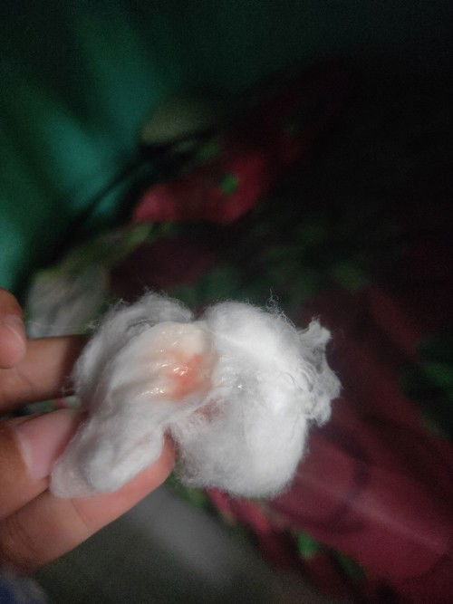 Flek tanda persalinan kah?