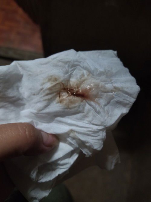 มีเลือดออก