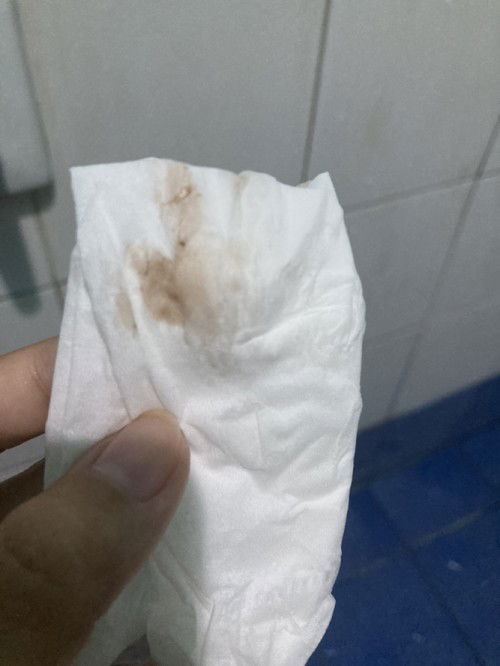 ประจำเดือนไม่มา